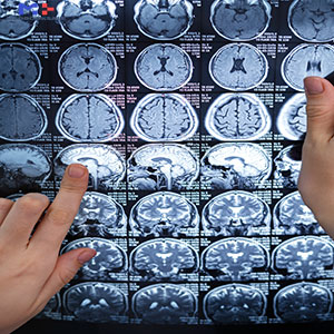 Neurosurgery